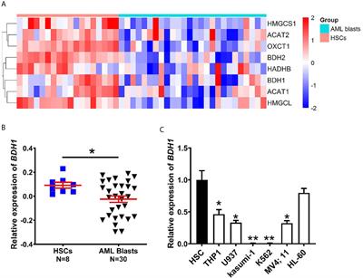 Anti-Tumor Effects of BDH1 in Acute Myeloid Leukemia